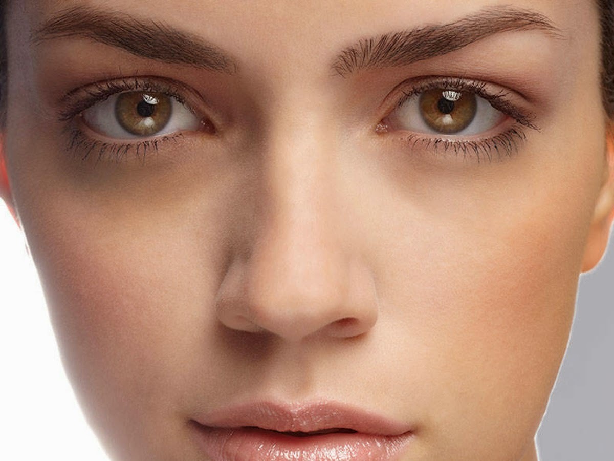 7 Tips To Remove Dark Circles Around Eyes