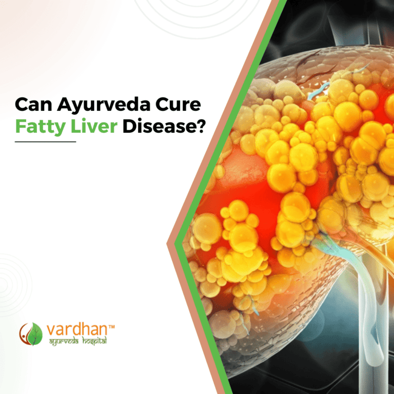 Can Ayurveda Cure Fatty Liver Diseases