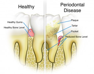 Can You Go To The Er For Tooth Pain