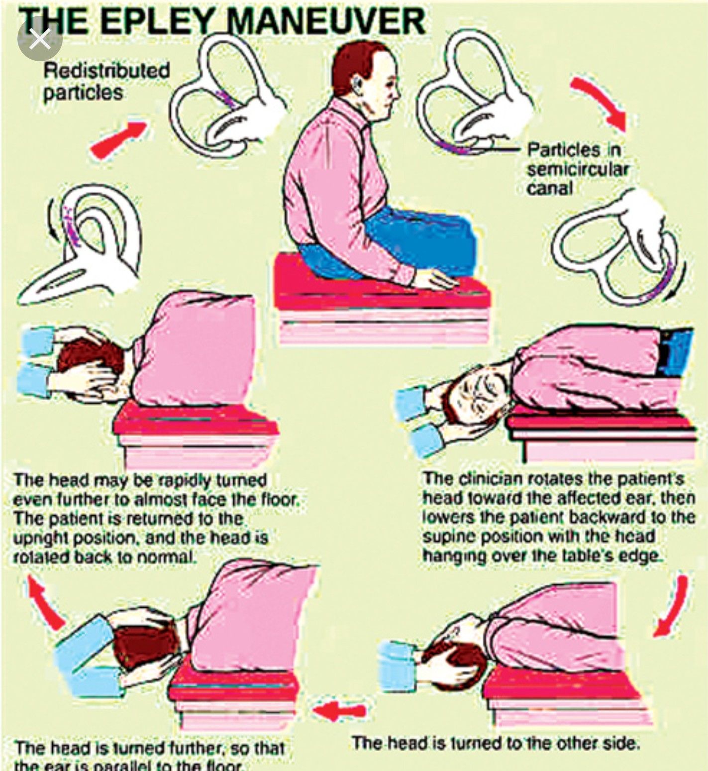 Epley Maneuver Vertigo Exercises Clean Body Easy Workouts Physical