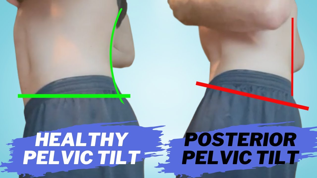 How To Safely Pop Your Pelvis For Instant Relief Youtube