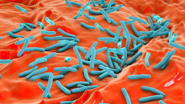 Ongoing Tuberculosis Outbreak In Kansas City Is Largest In Us History