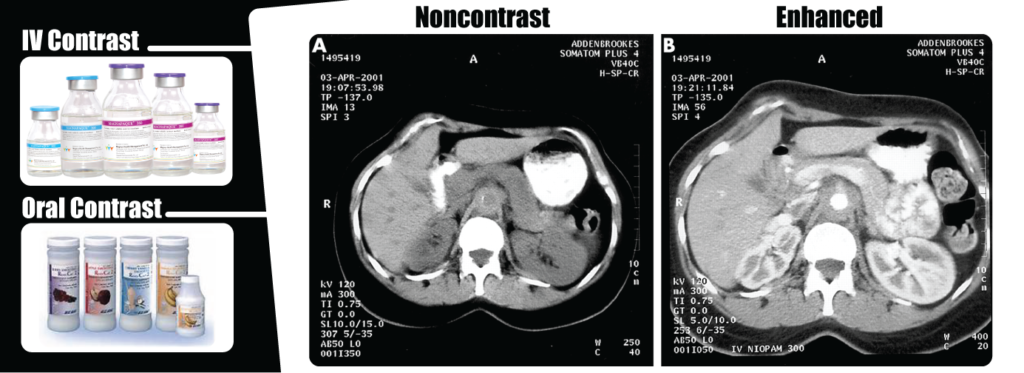 Oral Contrast Preparation: A Guide To Comfortable Ct Scans