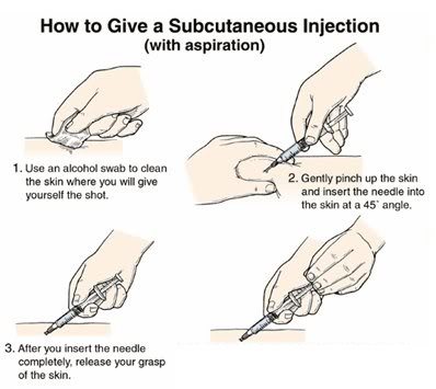 Subq Injection Angle: Mastering Technique For Precision