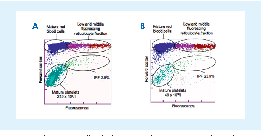 What's The Immature Platelet Fraction All About? Unraveling Blood Mysteries