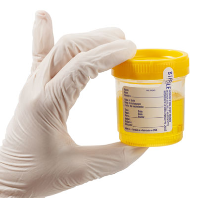 Why Do Urine Analysis? Uncover The Truth